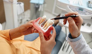 A patient holding tooth model while a dentist explains dental implant recovery